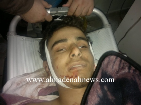 الرمثا : وفاة سوري ووصول 14 مصابا الى المستشفى الحكومي (اسماء وصور)